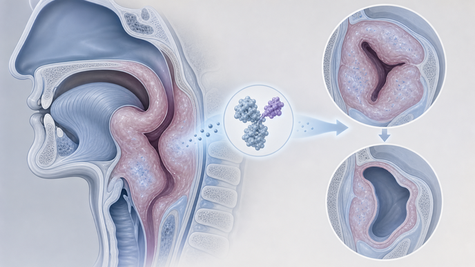 lonvoguran ziclumeran lowers hereditary angioedema attacks