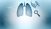 Understanding the Complexities of Small Cell Lung Cancer