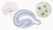 CA2 Microglia Track αSynuclein in Lewy Body Disease