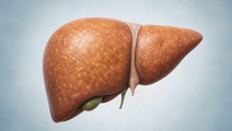 MASLD Recognition Lags Fatty Liver Disease in US Survey
