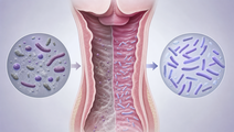 adjunct vaginal lactic acid with metronidazole for bacterial vaginosis