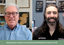 Breaking the Topical Corticosteroid Retreatment Cycle in CHE