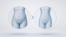 semaglutide 72 mg in obesity step up trial readout