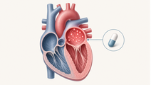 DOAC at Discharge Linked to Lower AF Adverse Events