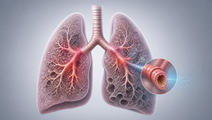 astegolimab trial readout in frequent exacerbator copd