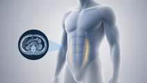Tirzepatide body composition illustration showing reduced abdominal fat and lean tissue overlay