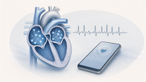 Smartphone Photoplethysmography Before Cardioversion in the SMARTBEATS Trial