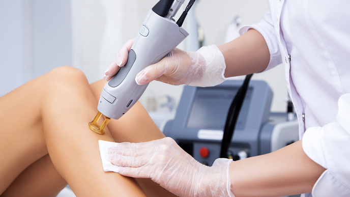 Laser hair removal