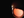Figure 2. A well-centered one-piece acrylic IOL in the left eye.