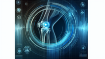 ai powered predictions osteoarthritis