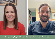 Recognizing Atypical Presentations of Inflammatory Dermatoses
