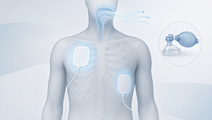 CPR Simulation Finds Little Oxygen Build Up Before Defibrillation