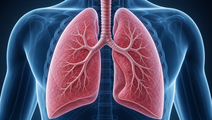 AECOPD Mortality Model Uses Hemoglobin and Albumin