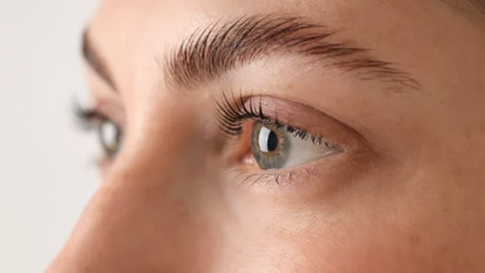 Brow Lift
