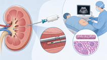 Cross Sectional Coaxial Renal Biopsy Improved Adequacy