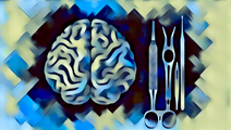 The Role of Neuroendoscopic Surgery in Managing Cystic Craniopharyngiomas