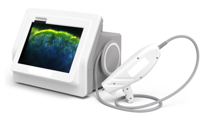 Enspectra Healths VIO handheld cross modal imaging system