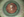 Figure. Anterior segment of the left eye.