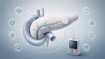 Stylized pancreas with continuous glucose monitor and insulin pump for type 1 diabetes