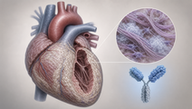 anselamimab misses overall endpoint signals kappa benefit in cares