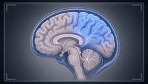 cerebral oxygenation guided resuscitation and mri outcomes in very preterm neonates