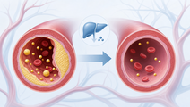 enlicitide outperformed oral nonstatin comparators in phase 3 trial