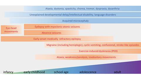 Toward Precision Medicine for Genetic Epilepsies Glucose Transporter Type 1 Deficiency Syndrome
