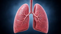 COPD With Eosinophils and Exacerbations Carries Higher Burden