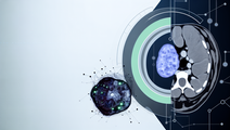 Leveraging Machine Learning and Enhanced CT for Improved Metastasis Prediction in Colon Cancer