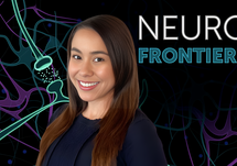 Rethinking Schizophrenia Guidelines: Why It’s Time to Incorporate Novel Mechanisms