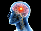 Decision in Context: A Practical Framework for Sequencing Systemic and CNS Ther…