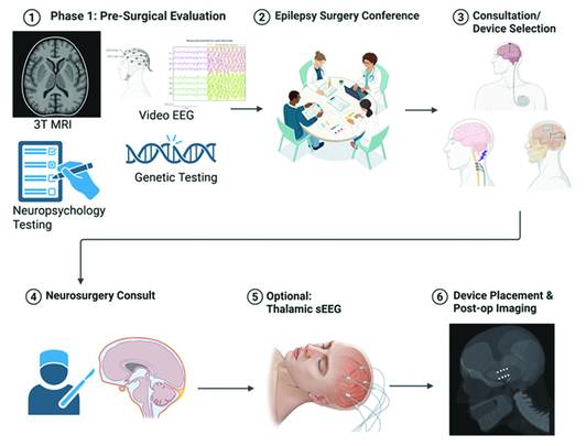 Figure 1 from the article by Dr Edmond appearing in the November 2025 issue of Practical Neurology