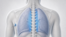 liposomal bupivacaine tpvb not superior to ropivacaine in thoracoscopic surgery