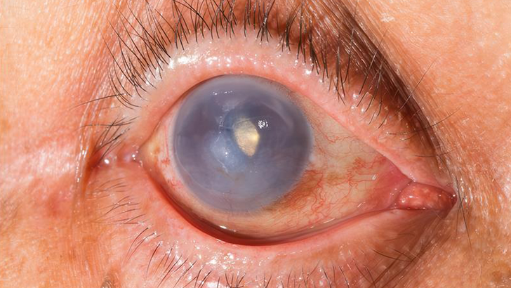 RMD Healthcare Image