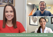 Treating Atopic Dermatitis in Sensitive and High-Impact Areas