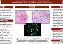 IgAN Poster 4 Image