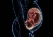 Targeting the Fc Receptor Pathway to Treat Red Blood Cell Alloimmunization