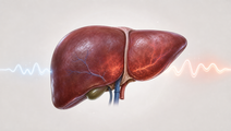 Stylized liver graft after normothermic machine perfusion with perfusion waveform