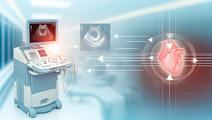 Understanding Advanced Imaging and Its Impact on Post Myocardial Infarction Care