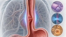 Survival Improvements in Recurrent and Metastatic ESCC Cohort