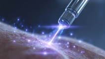 aesthetic medicine microneedling