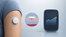 real time cgm lowers hba1c vs smbg in type 2 diabetes