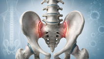 vunakizumab in radiographic axial spondyloarthritis trial