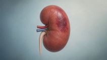 Illustrated kidney with subtle tissue changes representing acute kidney injury risk in emergency ICU patients