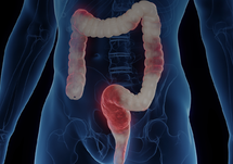 APP Biosimilar Education Video Series Module 3