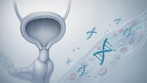 ctdna guided atezolizumab extends survival after cystectomy