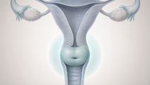 Simplified cervix and lower uterus illustration representing cervical cancer screening