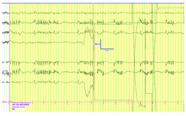 PN0925 EE Fig 2C