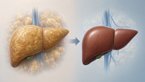 lifestyle program sustains metabolic syndrome remission
