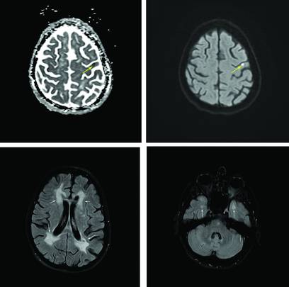PN0825 CR Fig3